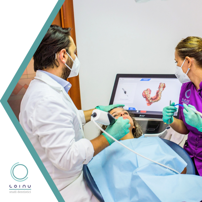 Impronta dentale