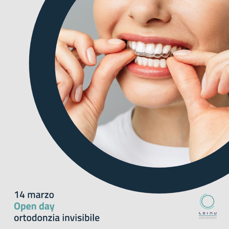 14 marzo 2023: OPEN DAY ortodonzia invisibile