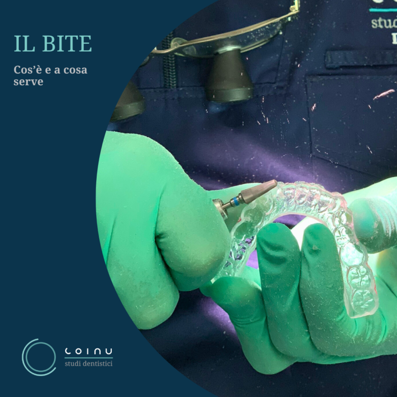 Bite e malocclusione