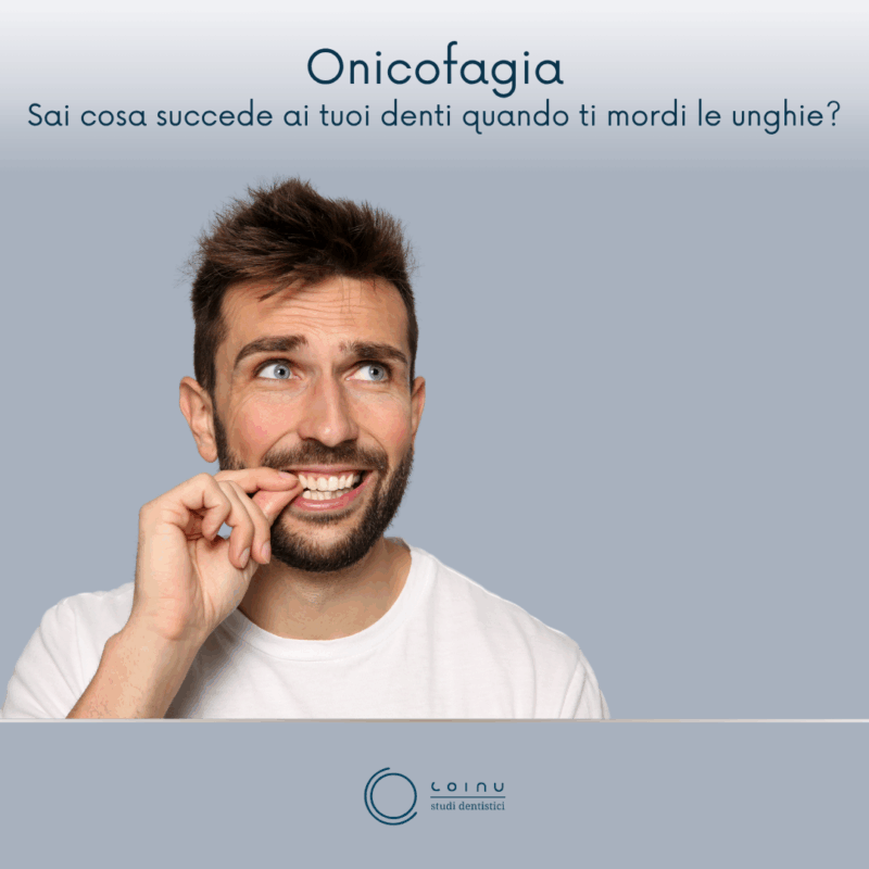 Onicofagia: Ti mordi spesso le unghie?